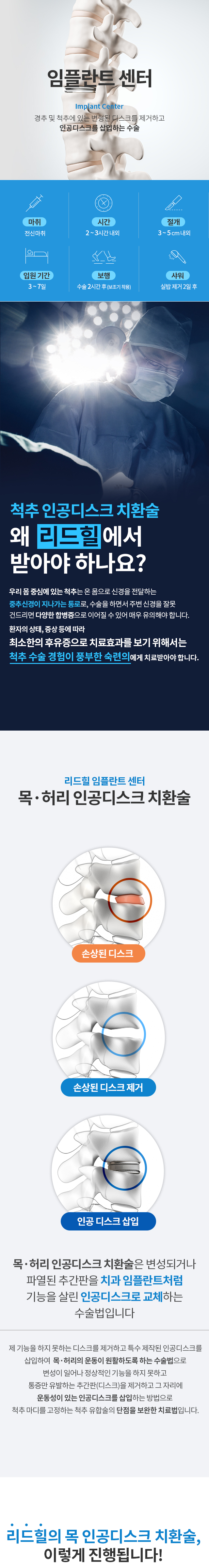 임플란트센터