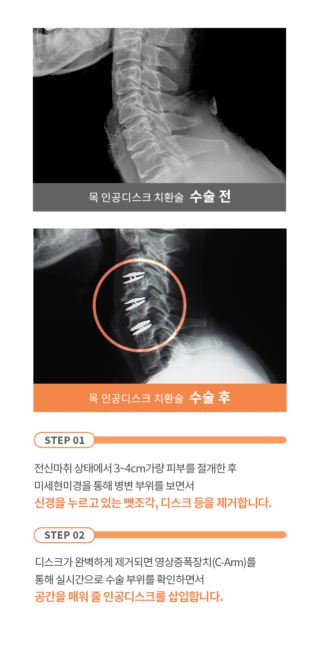 임플란트센터